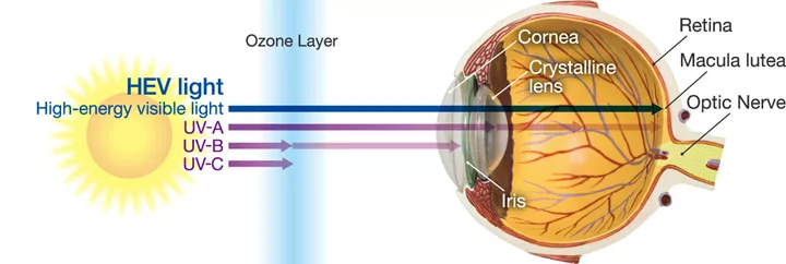 How Does Blue Light Affect My Eyes